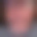 Bespreken met azalphoch3252191912